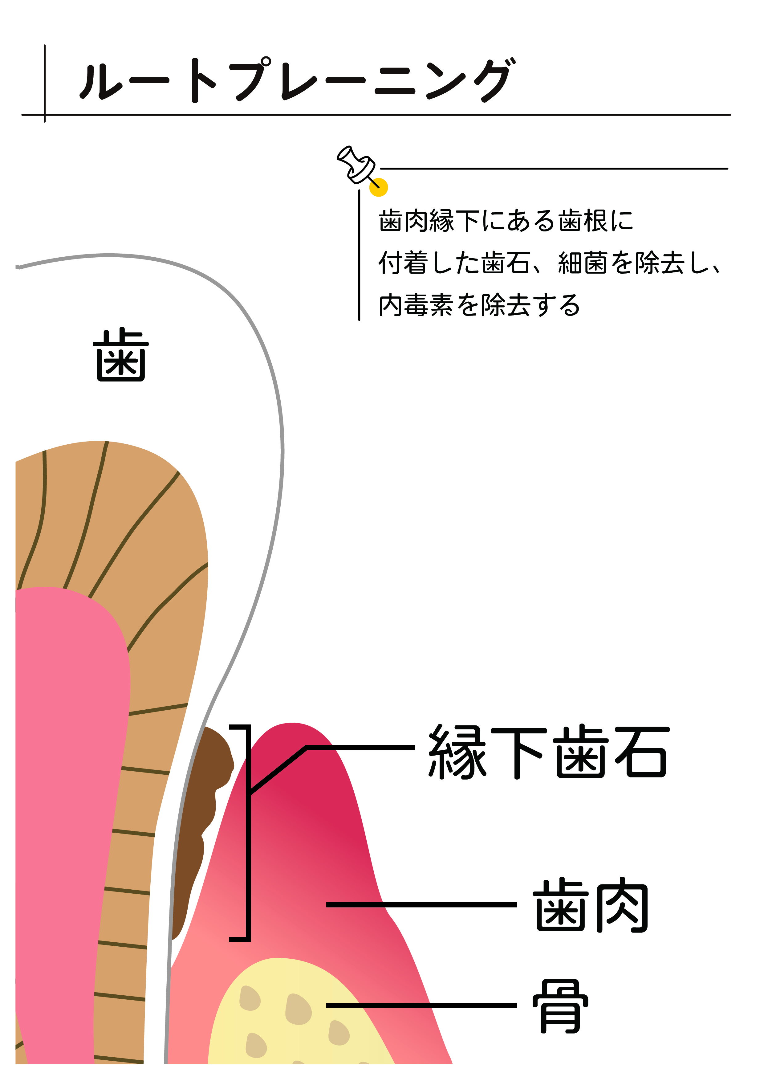 ループトレーニング